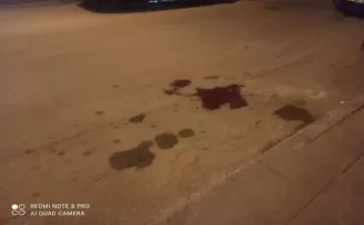 Ankara’da silahlı saldırı sonucu bir vatandaş iki bacağından birden vuruldu
