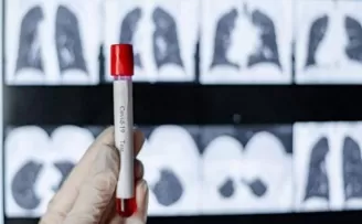Covid-19 sonrası akciğerlerde kalıcı hasar endişesi
