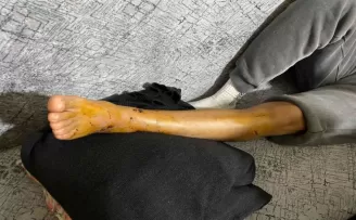 İstanbul’un göbeğinde pitbull dehşeti kamerada
