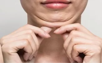 Keşanlı 3 dermatolog, Tiflis’teki Dermavizyon toplantısında buluştu