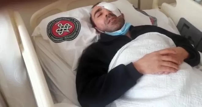 Avcılar’da trafik magandaları kameramanın gözünü kör etti
