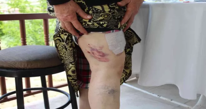 Başıboş köpeklerin saldırdığı yaşlı kadın ölümden döndü
