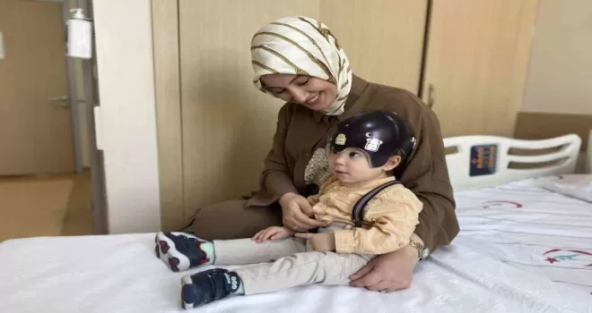 Bebeklerde kafatası şekil bozukluğuna dikkat!
