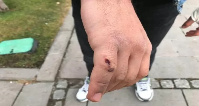 “Canım acıdı” denilerek darp edilen sağlıkçı o anları anlattı
