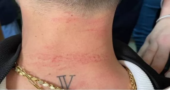 Cerrahpaşa Tıp Fakültesi’nde doktora saldıran şüpheli gözaltına alındı
