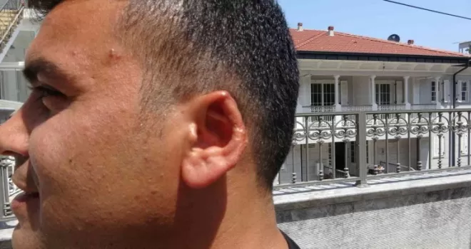 Film senaryolarını aratmayacak olay: Kavgada kopan kulağını martı kaptı
