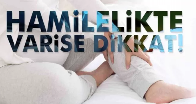 Hamilelikte varis gelişimine dikkat
