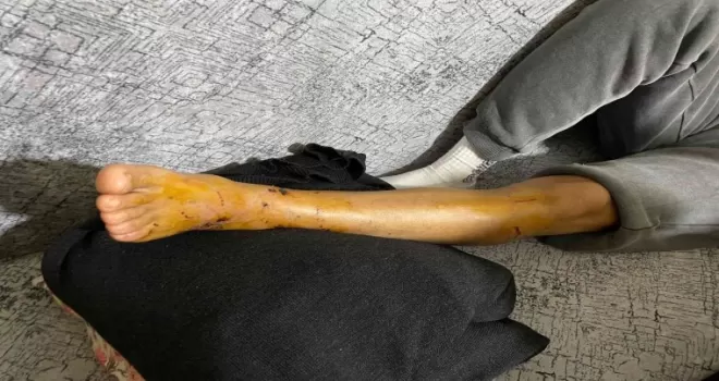 İstanbul’un göbeğinde pitbull dehşeti kamerada
