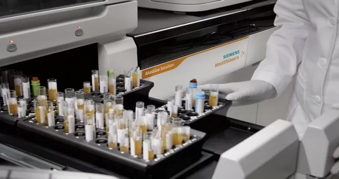 Koronavirüse karşı bağışıklık ölçen test
