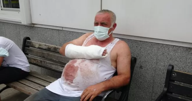 Kurban keserken arkadaş kurbanı oldu