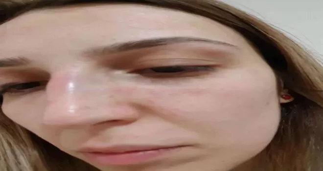 Mahalle muhtarı eski sevgilisine dehşeti yaşattı
