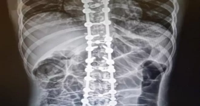 “Osteopati tedavisinde hastalık yoktur, hasta vardır”
