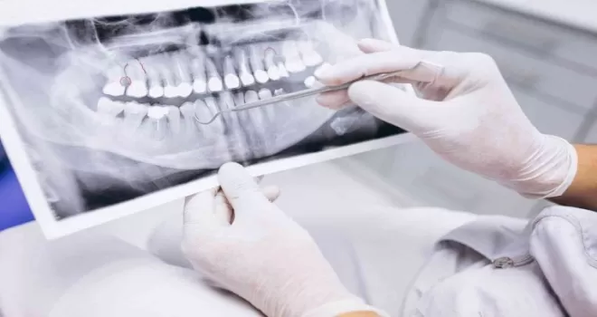 Sigara, diş tedavi sürecini olumsuz etkiliyor
