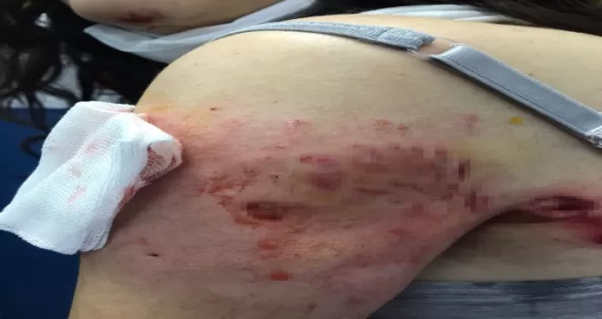Sokak köpekleri genç kıza saldırdı
