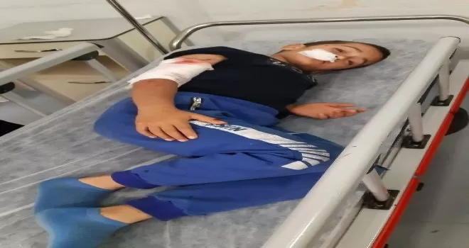 Sultangazi’de 10 yaşındaki çocuğa köpek saldırdı
