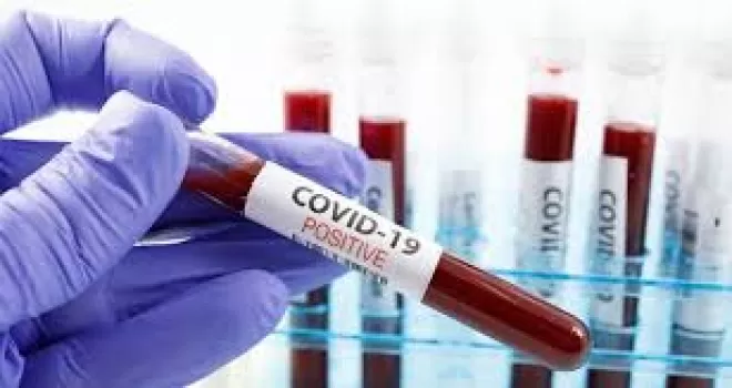 Trabzonlu Başkan Covid-19 a yakalandı! 